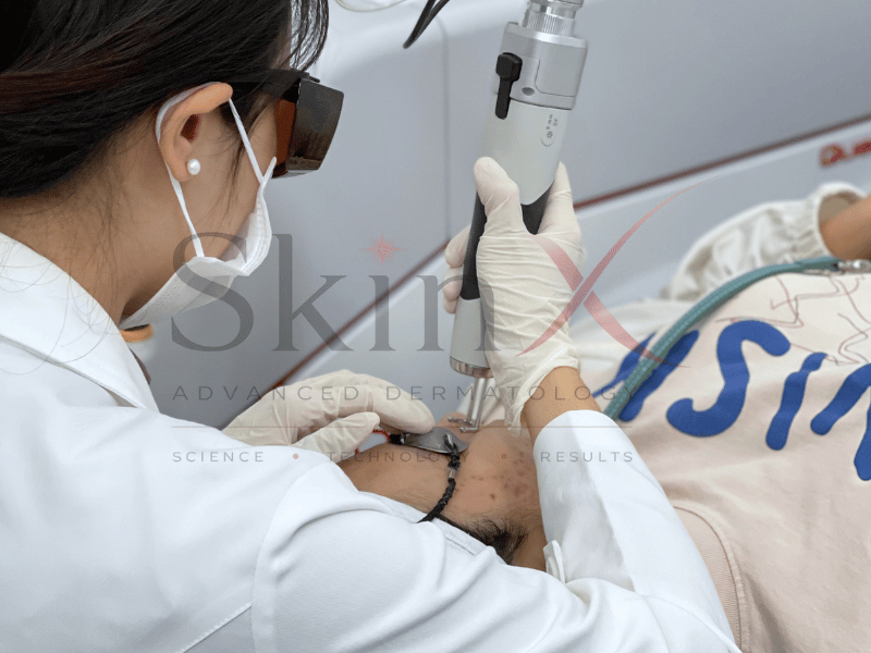 Fotoona Dynamis là hệ thống laser 2 bước sóng hiệu đại giải quyết được nhiều vấn đề của làn da